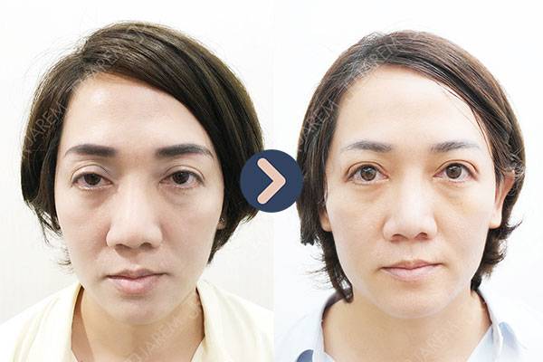 ทำตา-จาเรมคลินิก