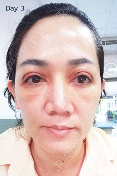 ทำตาสองชั้น