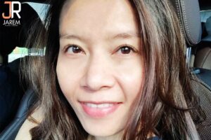 รีวิวตา รักษากล้ามเนื้อตาอ่อนแรงแต่กำเนิด จากคนผิวบาง ช้ำง่าย