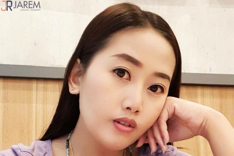 แก้ตาตก