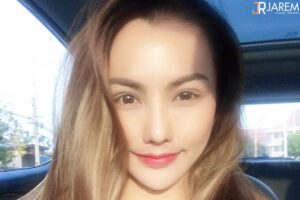 รีวิวแก้ตา หลังทำตาสองชั้น กล้ามเนื้อตาอ่อนแรงแทรกซ้อน