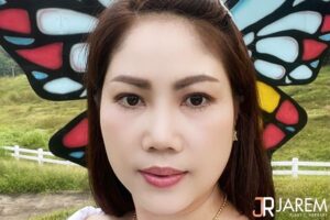 หางตาตก อีกหนึ่งปัญหาที่ทำให้หน้าดุและดูมีอายุ