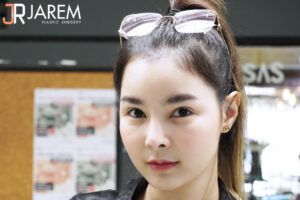 แก้ตาสองชั้นครั้งที่ 4 แก้ตาที่เกาหลีก็สู้ครั้งนี้ไม่ได้