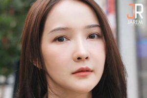 แก้ตาสองชั้นกรีดยาวกับหมอยุ้ย ตาสวยหวาน งานเข้าเพียบ!