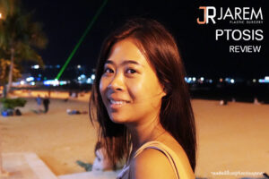 ตาตก ชั้นตาไม่ชัดเจน เกิดจากอะไร แก้ไขได้อย่างไร?