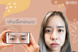 เปลี่ยนตาตก ตาง่วงนอน เป็นตาสวยสดใสทรงอัลมอนด์