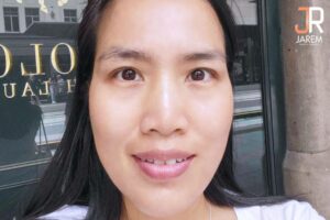 ตาปรือ ชั้นตาหลายชั้น ดูง่วงนอน ไม่สดใส แก้ยังไง???