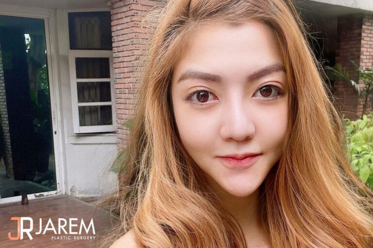 ตาไม่เท่ากัน ทำไงดี