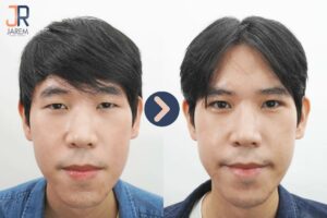 ผู้ชายทำตาจะเป็นอย่างไร? มาดูรีวิวตาผู้ชายกันเลย