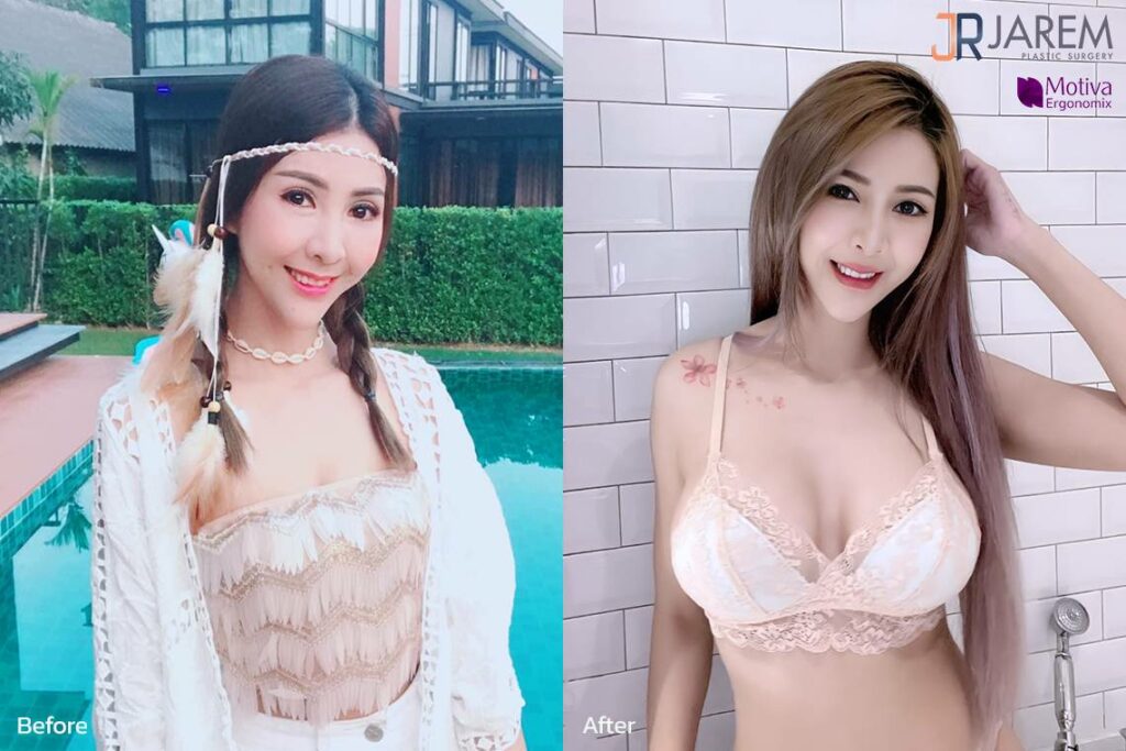 ยกกระชับ