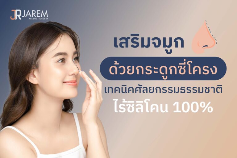 เสริมจมูกด้วยกระดูกซี่โครง เทคนิคศัลยกรรมธรรมชาติ ไร้ซิลิโคน 100%