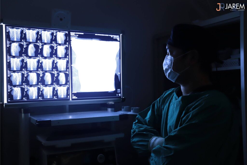 CT scan for Ribxcar 02