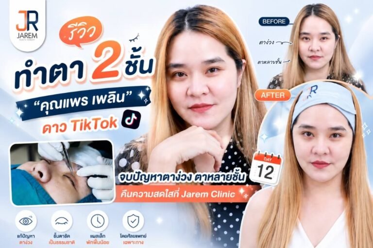 รีวิวทำตา 2 ชั้น แก้ปัญหาตาง่วง-ตาหลายชั้น คืนความสดใสในวัยใกล้ 40 สไตล์ธรรมชาติ โดยคุณแพร เพลิน | Jarem Clinic