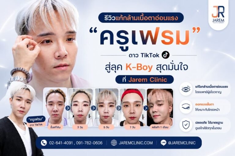 รีวิวแก้กล้ามเนื้อตาอ่อนแรงผู้ชาย สลัดลุค “ตาหมาหงอย” สู่ดวงตาสดใสสไตล์ K-Boy โดยคุณหมอยุ้ย จาเรมคลินิก | Jarem Clinic