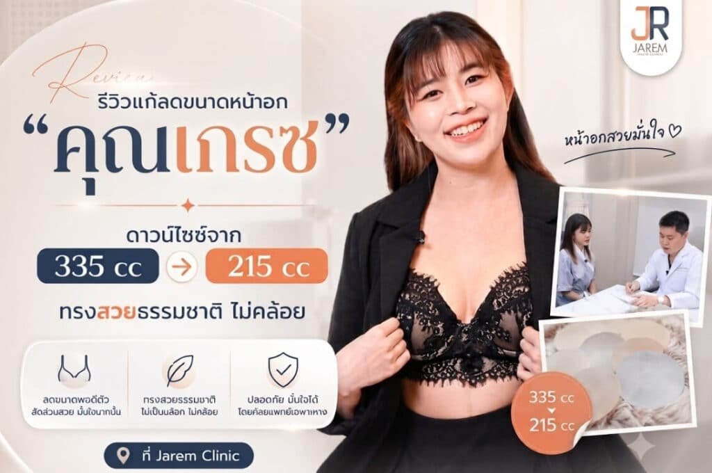 รีวิวแก้ลดขนาดหน้าอกคุณเกรซ 335 cc เป็น 215 cc โดยคุณหมอ หลุยส์ Jarem Clinic