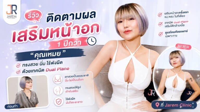 รีวิวตรวจหน้าอกหลังเสริม 1 ปี คุณเหมย จาเรมคลินิก