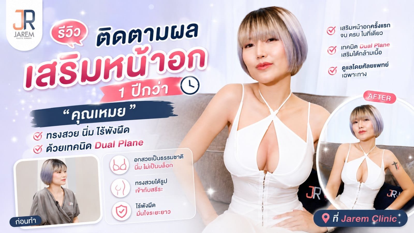 รีวิวตรวจหน้าอกหลังเสริม 1 ปี “คุณเหมย” ทรงสวย นิ่ม ไม่มีพังผืด