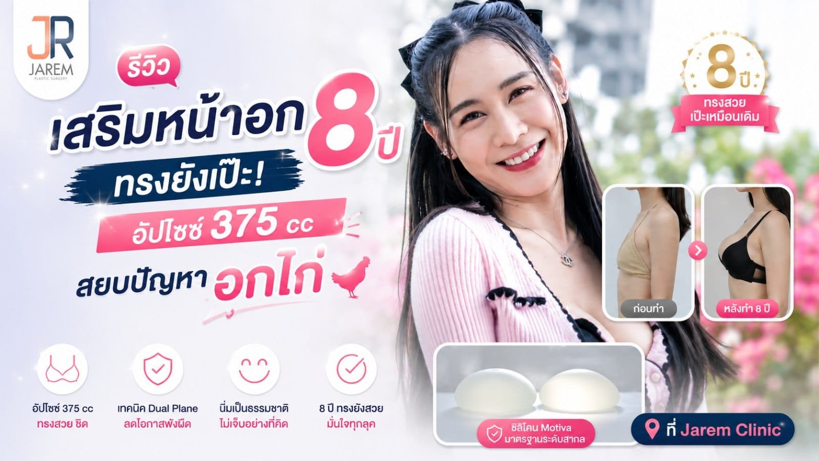 รีวิวเสริมหน้าอก 8 ปี ทรงยังสวย “คุณอ๋อม” 375 cc ที่จาเรมคลินิก
