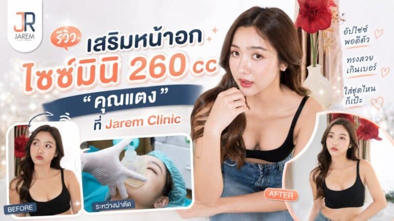 รีวิวเสริมหน้าอกไซซ์มินิ 260 cc คุณแตง จาเรมคลินิก