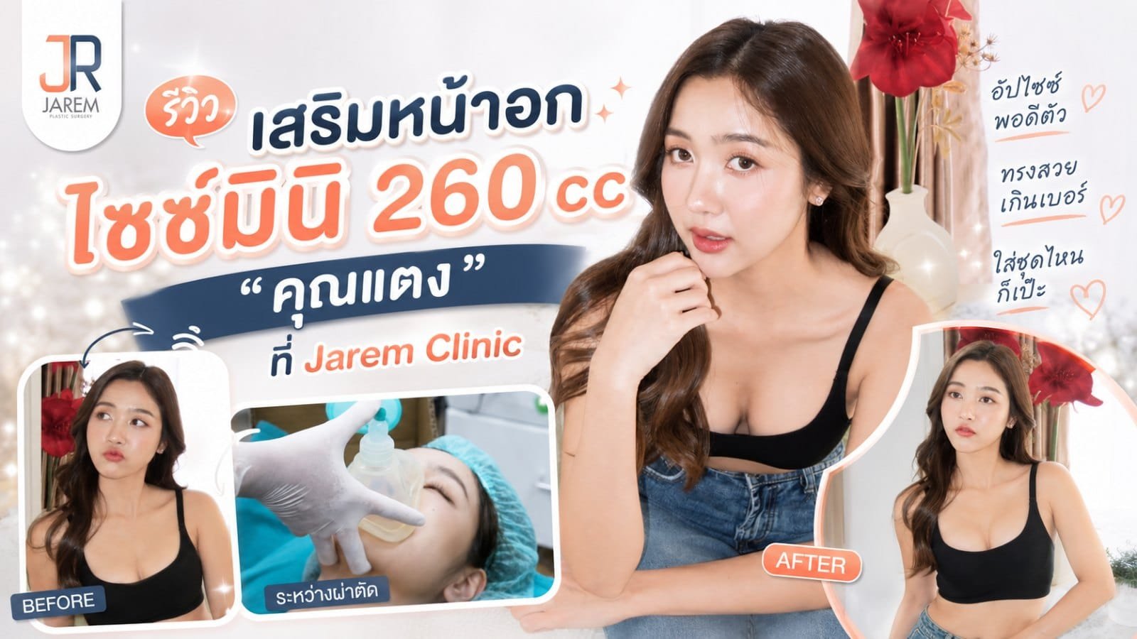 รีวิวเสริมหน้าอกไซซ์มินิ 260 cc คุณแตง นางแบบที่ขอแค่พอดีตัว
