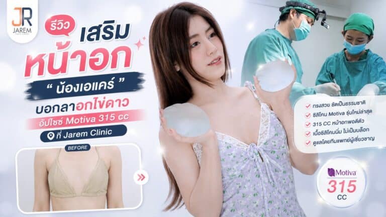 รีวิวเสริมหน้าอก น้องเอแคร์ อัปไซซ์ Motiva 315 cc ทรงธรรมชาติ จาเรมคลินิก